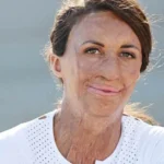 Turia Pitt