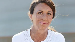 Turia Pitt